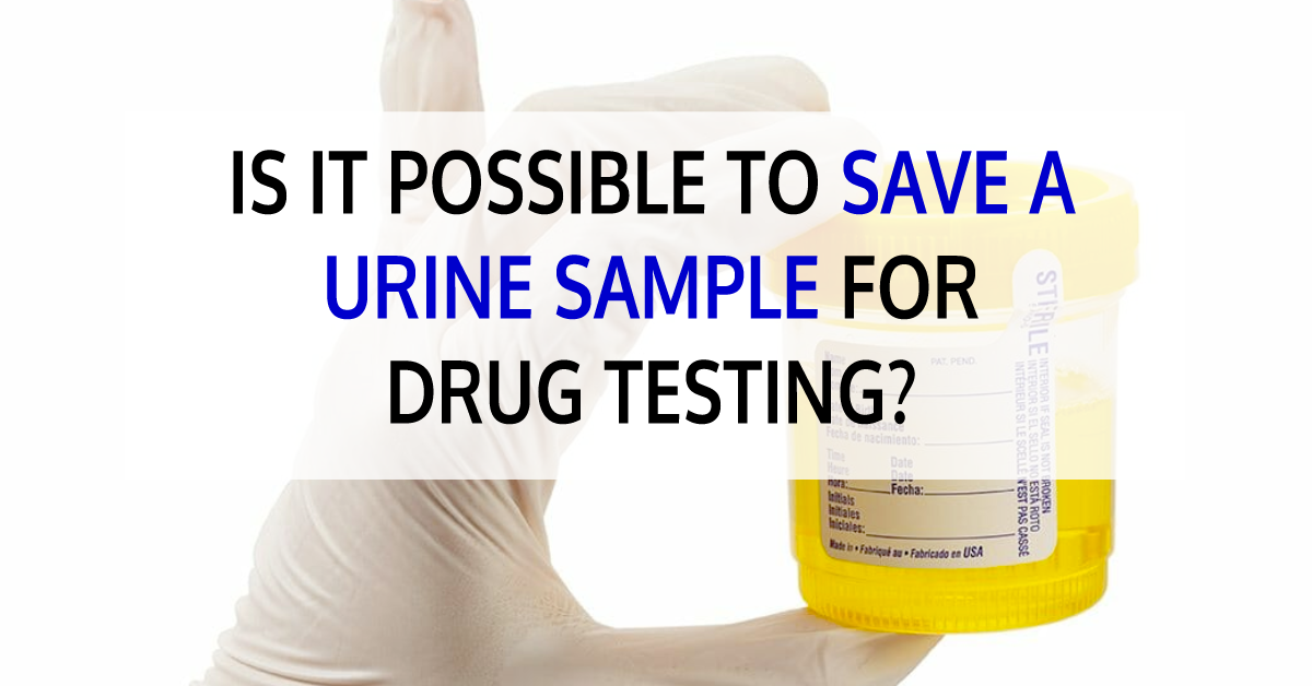 Is It Possible To Store A Urine Sample For Drug Testing? | Calculator |  Marijuana Central