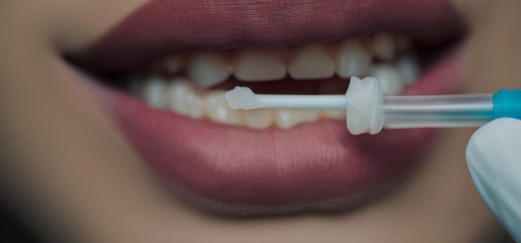 How Far Back a Mouth Swab Drug Test Can Detect Substance Use