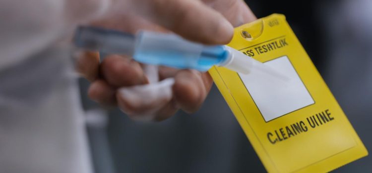 Passing a Drug Test After Delta-8 THC: What You Need to Know